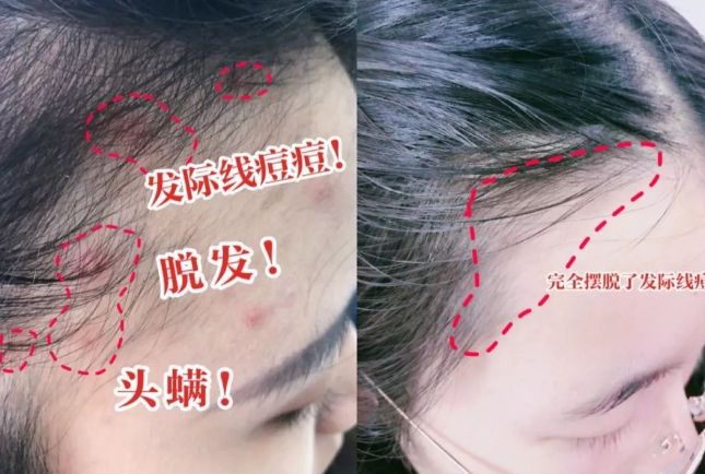 好？10分钟轻松养成女明星「绸缎发」开元棋牌app洗完头自然风干还是吹干(图14)